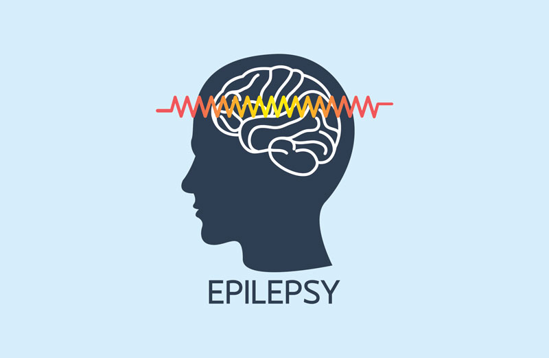 COVID-19 and epilepsy: Frequently asked questions