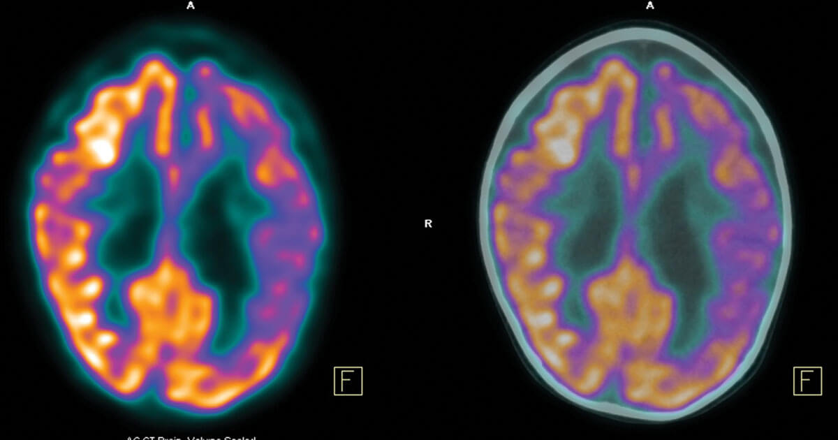 Why do neurologists prescribe CT, MRI, and PET scans?