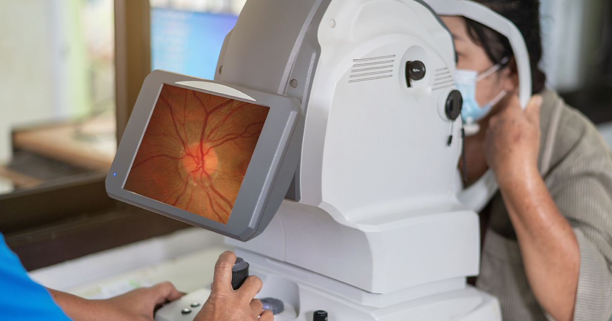 What is ocular migraine and how is it treated? 