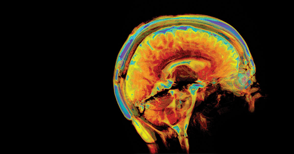 What is a functional neurologic disorder?