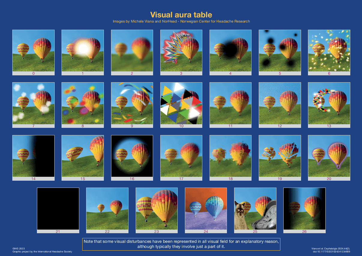 Migraine visual aura chart showing common visual symptoms such as flashing lights, blind spots, zigzag patterns, blurred vision, and vision loss