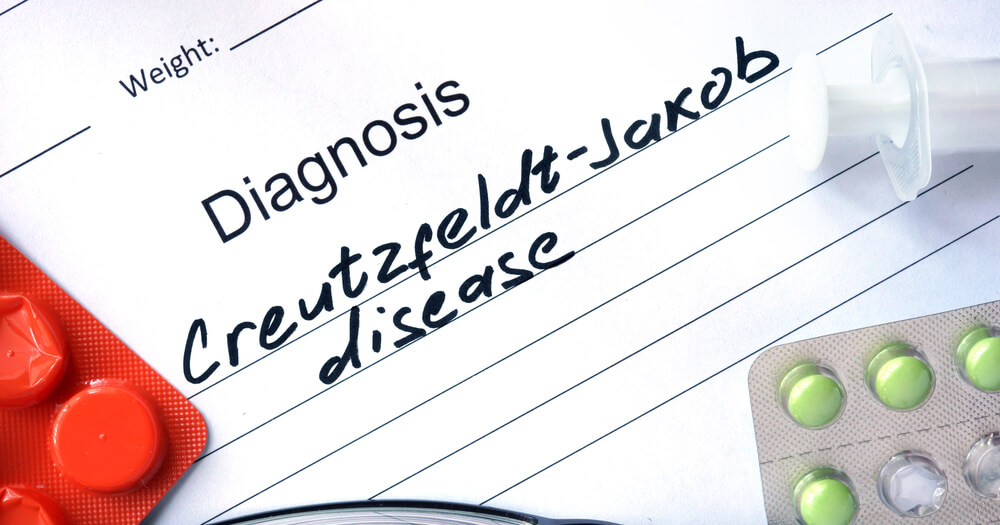 The José Baselga fund offers grant for research into prion diseases