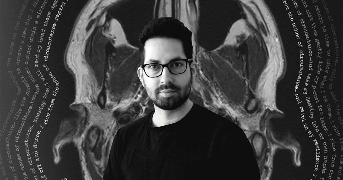 An artist uses his work to accept autoimmune disorder and changing abilities