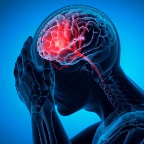 Man with a headache 