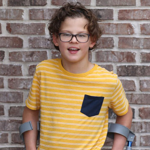 Gavin McHugh is building an acting career and a community with cerebral palsy