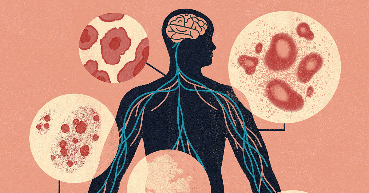 Skin problems may be early signs of a neurologic condition