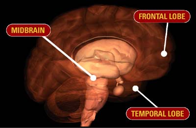 The connection between boxing and brain injury